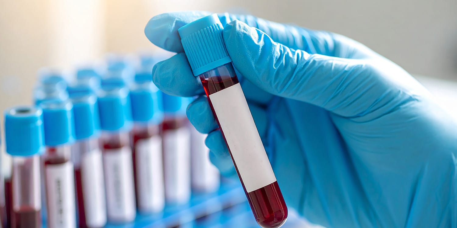 Blood Test