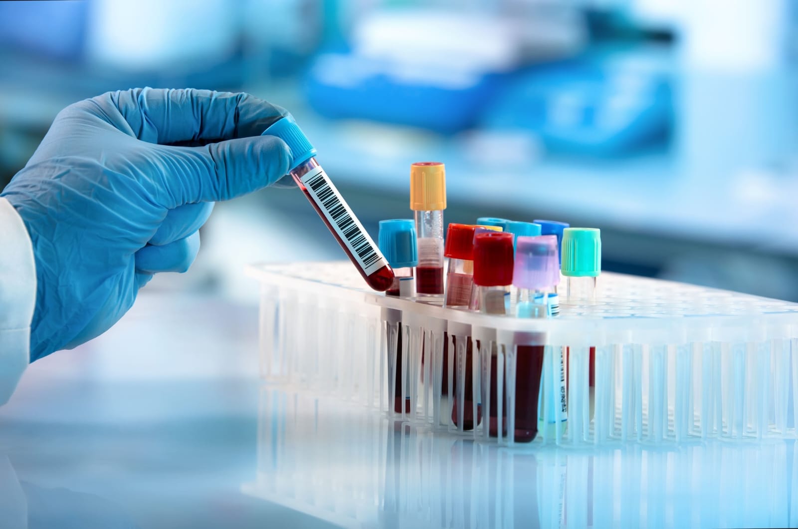 Diagnostic Test