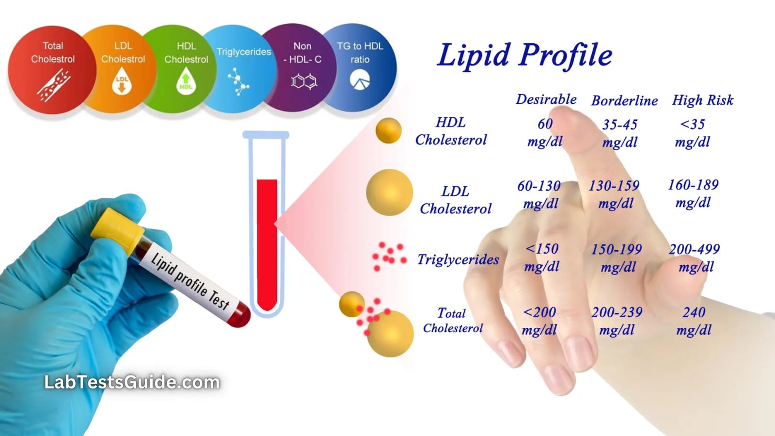 Lipid Profile