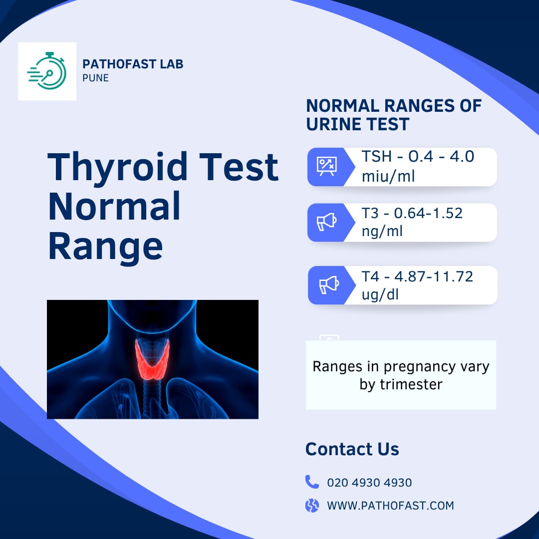 Thyroid Profile